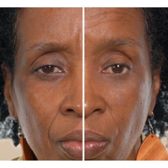 Tint & Tighten Instant Color Smoothing Cream Dark/Deep 9 (0.18 fl oz) Tubes, NIB - Picture 7 of 10